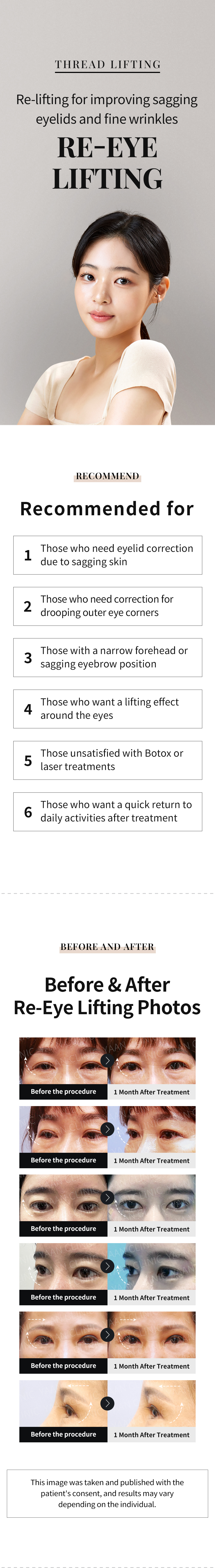 RE-EYE FTING