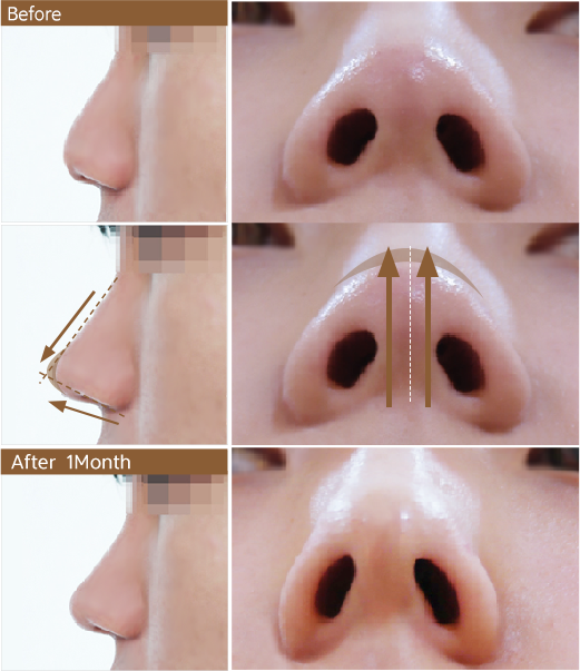 Nose