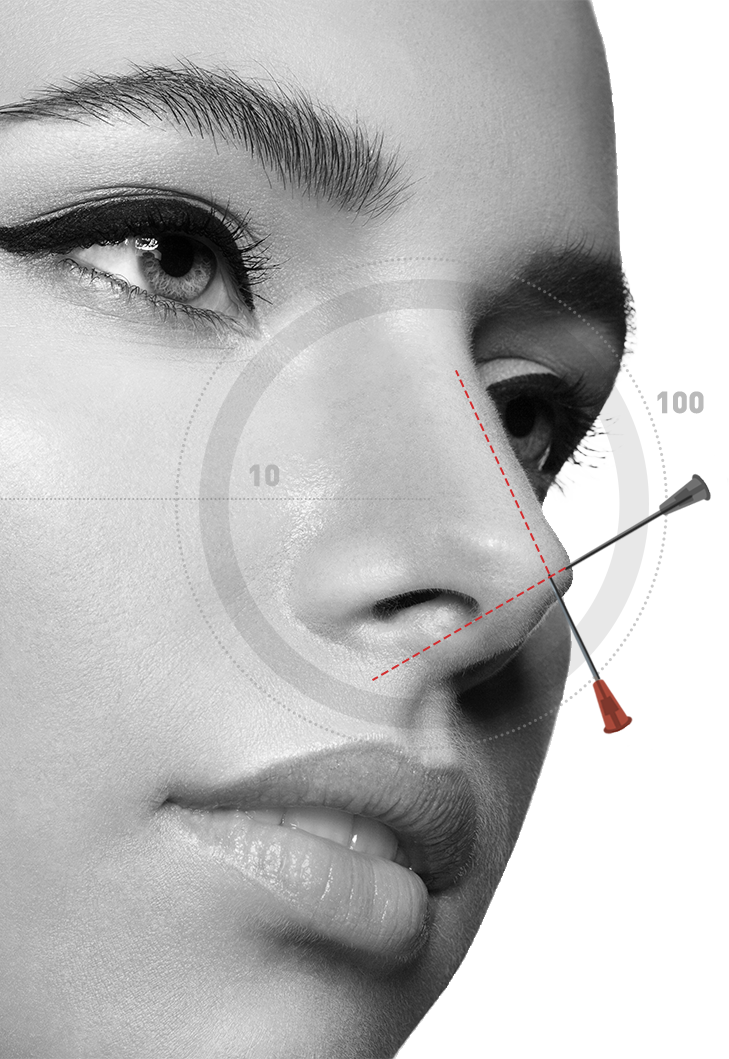 Nose