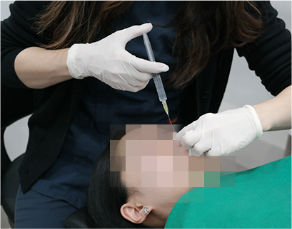 procedure
