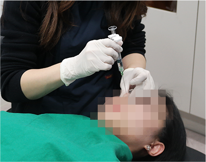 procedure