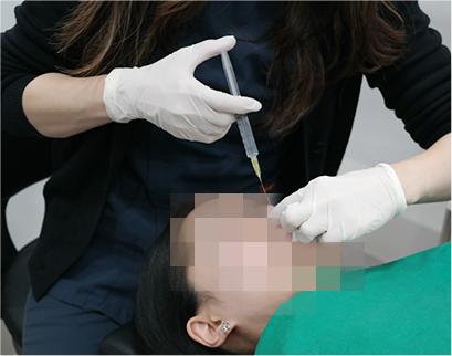 procedure
