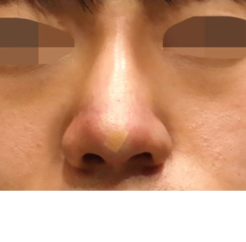 after