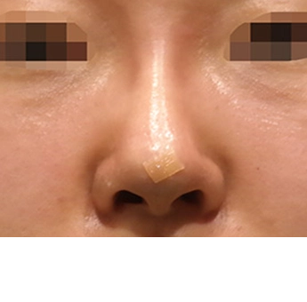 after