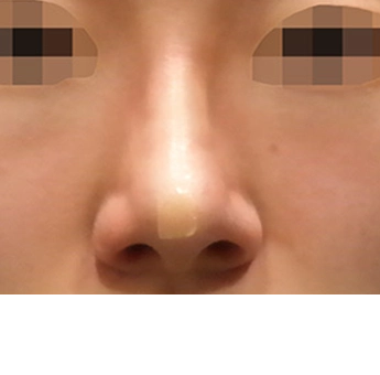 after