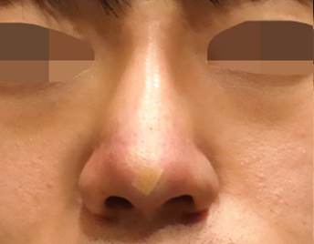 after