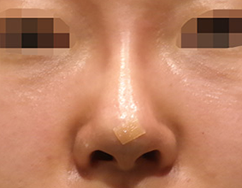 after