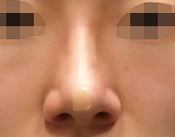after