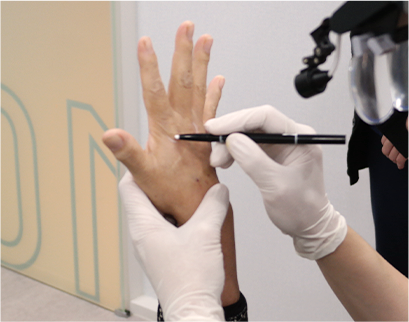 procedure4