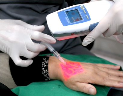 procedure5