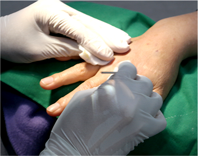 procedure6