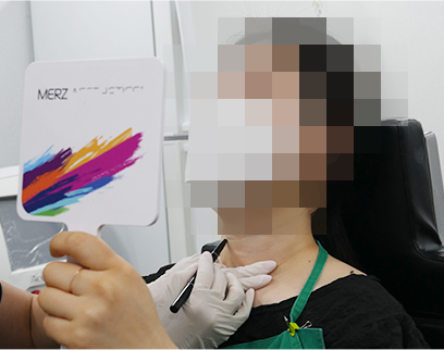 procedure3