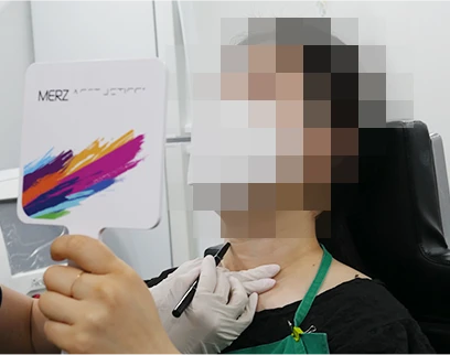 procedure3