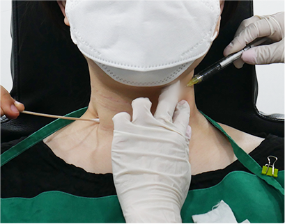 procedure4