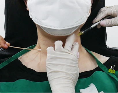 procedure4