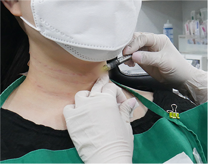procedure5