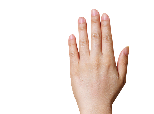hand