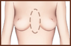 bra