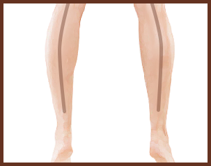 leg