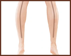 leg
