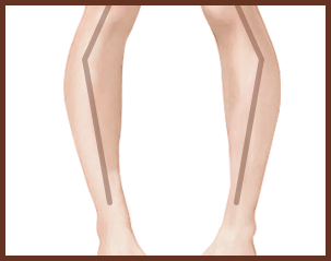 leg