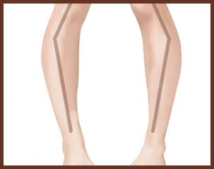 leg