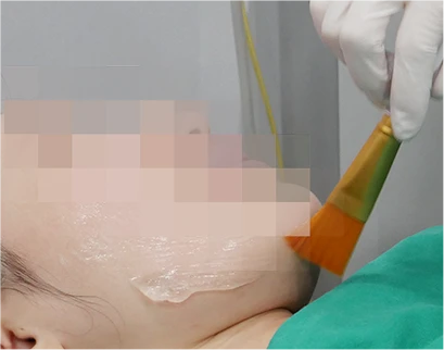 procedure