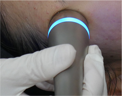 procedure