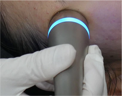 procedure