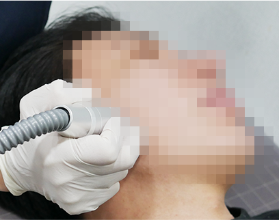 procedure