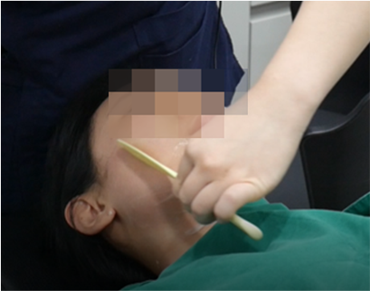 procedure