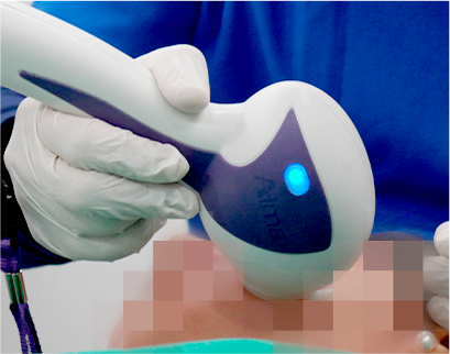 procedure