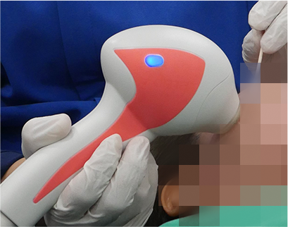 procedure