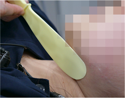 procedure