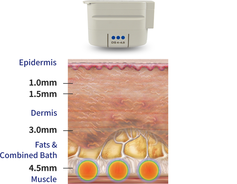 Mechanism of Action