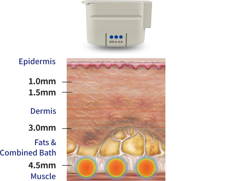 Mechanism of Action