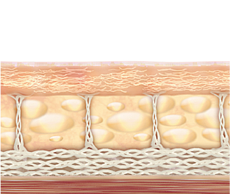 Tightened Skin