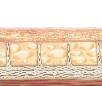 Tightened Skin