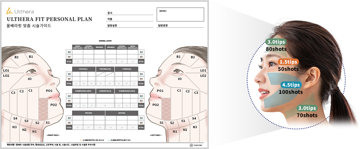 Ulthera Plan
