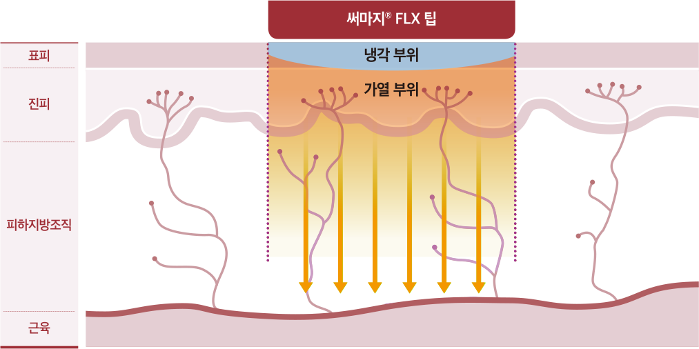 FLX팁