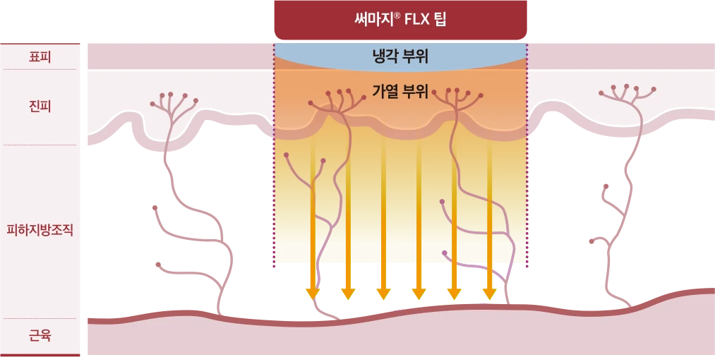 FLX팁