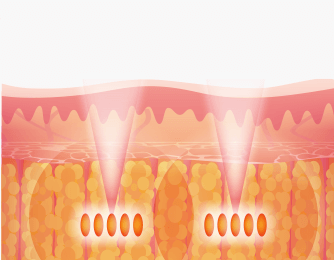 Energy transfer