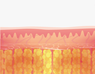 Inducing fat repositioning