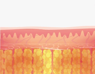 Inducing fat repositioning