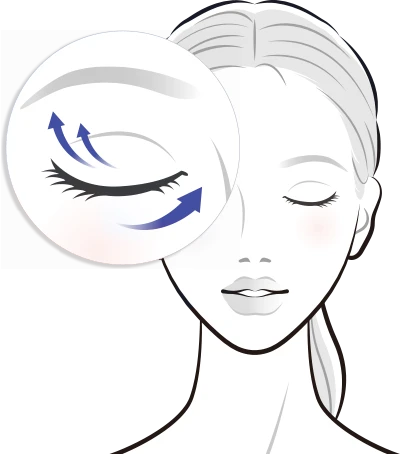 thermage_eye