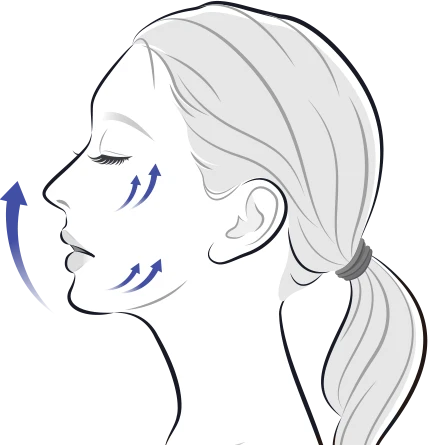 thermage_face