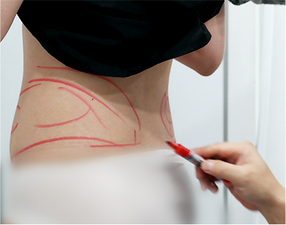 procedure