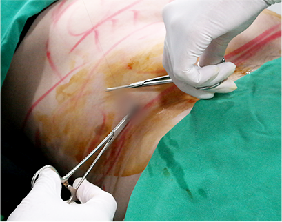 procedure