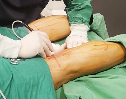 procedure