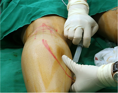 procedure